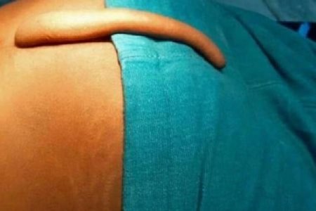 Azərbaycanda hər kəsi şoka salan hadisə - FOTO Azərbaycanda hər kəsi şoka salan hadisə - FOTO