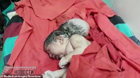 Hindistanda üçbaşlı uşaq dünyaya gəldi - FOTO