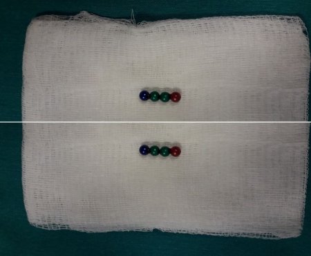 Bakıda azyaşlının qarnından çıxanlar şoka saldı - FOTO