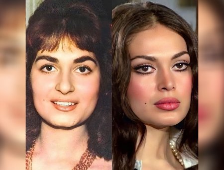 Türkan Şorayı dəyişdirən PLASTİK ƏMƏLİYYATLAR və QİYMƏTLƏRİ - FOTOLAR Türkan Şorayı dəyişdirən PLASTİK ƏMƏLİYYATLAR və QİYMƏTLƏRİ - FOTOLAR