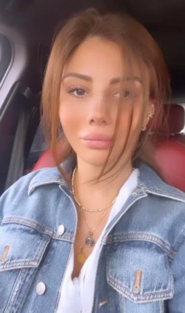 Ayselin plastik əməliyyatdan sonrakı halı - FOTO