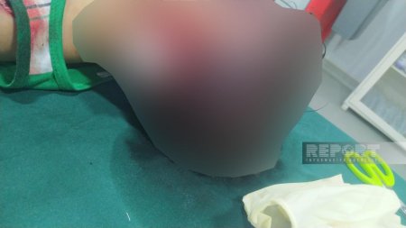 Bakıda dəhşət: itlər uşaqları parçaladı! - FOTOLAR