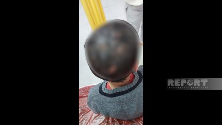 Bakıda dəhşət: itlər uşaqları parçaladı! - FOTOLAR