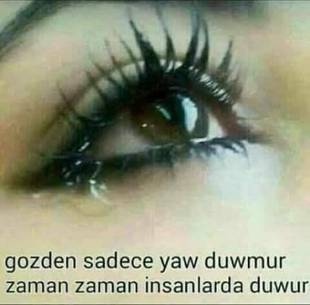 YANAR GÖZLƏR - FOTO