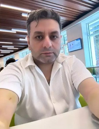 Əməliyyat olunan Elcanın son halı - FOTO